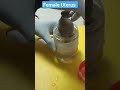Female Reproductive System Female Uterus Trending Reproduction Anatomy Lab Trending Mbbs