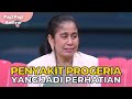 Cerita Puspa Yang Terkena Penyakit Langka Hingga Timbul Penuaan Dini PAGI PAGI AMBYAR 3 11 22 P3