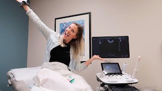 SONOHYSTEROGRAM RESULTS...NOW WHEN CAN WE DO IVF?
