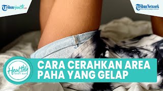Cara Ampuh Mencerahkan Area Paha yang Gelap dengan Bahan Alami, Termasuk Kentang dan Lidah Buaya