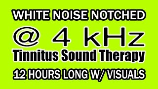 White Noise - Notch Filtered at 4 kHz for Tinnitus Therapy w/ Visuals