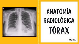 Anatomía Radiológica - Radiología Convencional: Tórax.