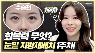 글로비지테라안티에이징의원 \u0026 스타힐링 사용 후기