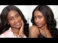 HOW I CLEARED MY HYPERPIGMENTATION & ACNE | UPDATED SKINCARE & AFFORDABLE  DUPES!!
