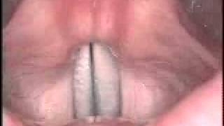 Rigid: vocal slide down