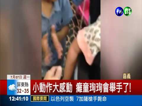 奇蹟! 車禍致癱 珣珣會舉手了