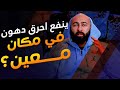 دهون في مكان معين | كيف اتخلص منها | ساموي