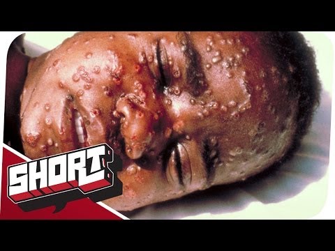 Pocken-Virus - Die konservierte Biowaffe!
