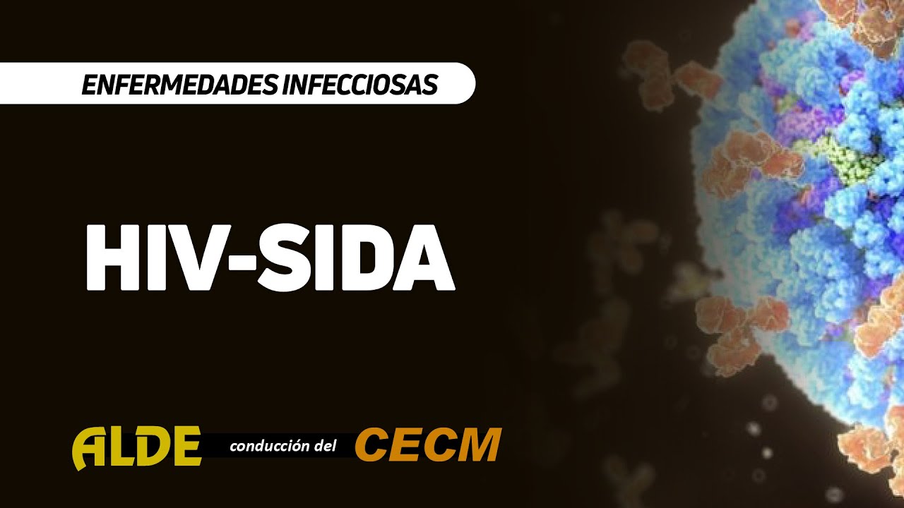 Curso Enfermedades Infecciosas. HIV-SIDA