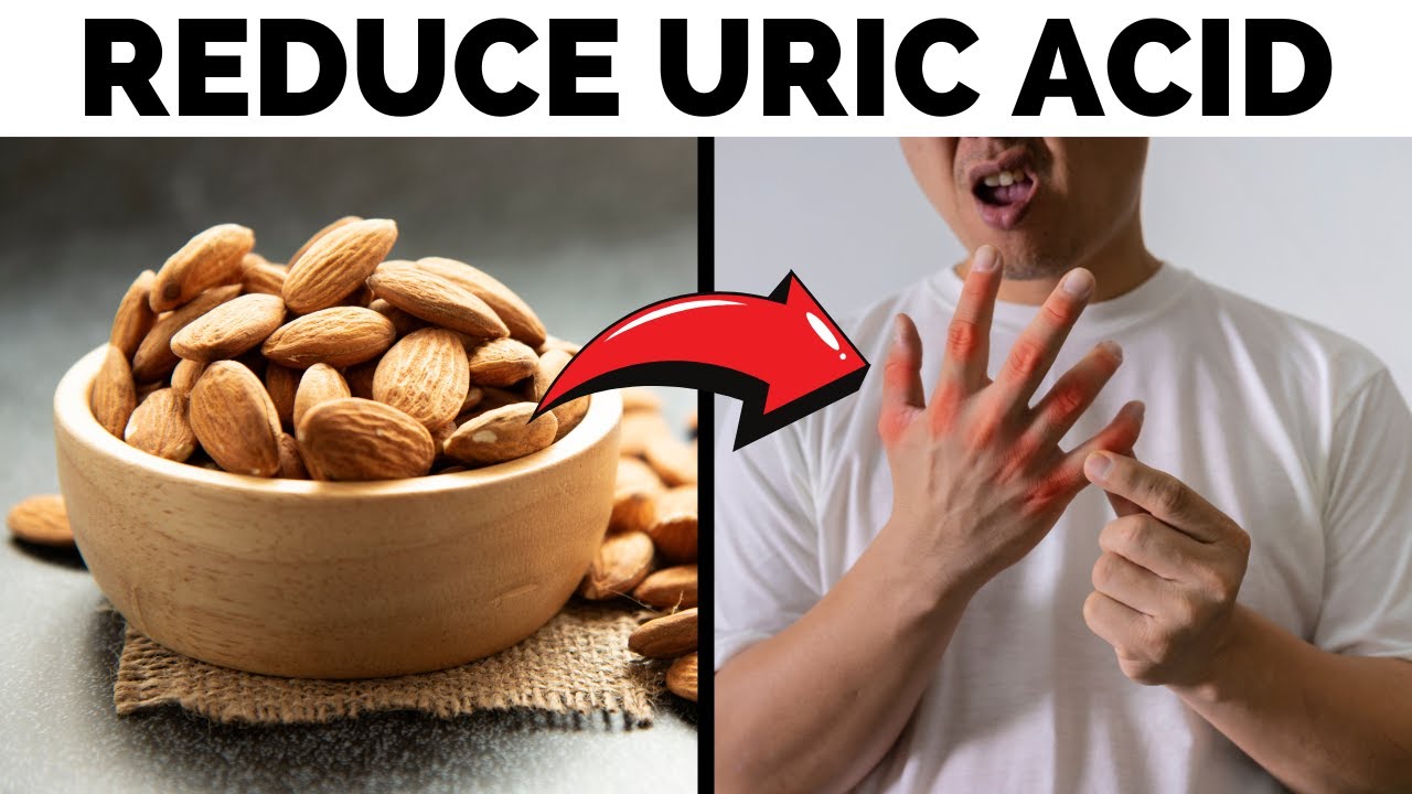 Reduce Uric Acid FAST with These 10 POWERFUL Dry Fruits!
