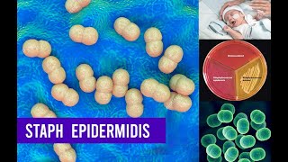 Staphylococcus Epidermidis Bacteria ( Complete Overview )