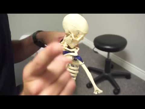 Shoulder Impingement Video