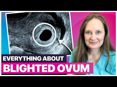 Blighted Ovum Explained: Causes, Diagnosis, and What to Do Next?