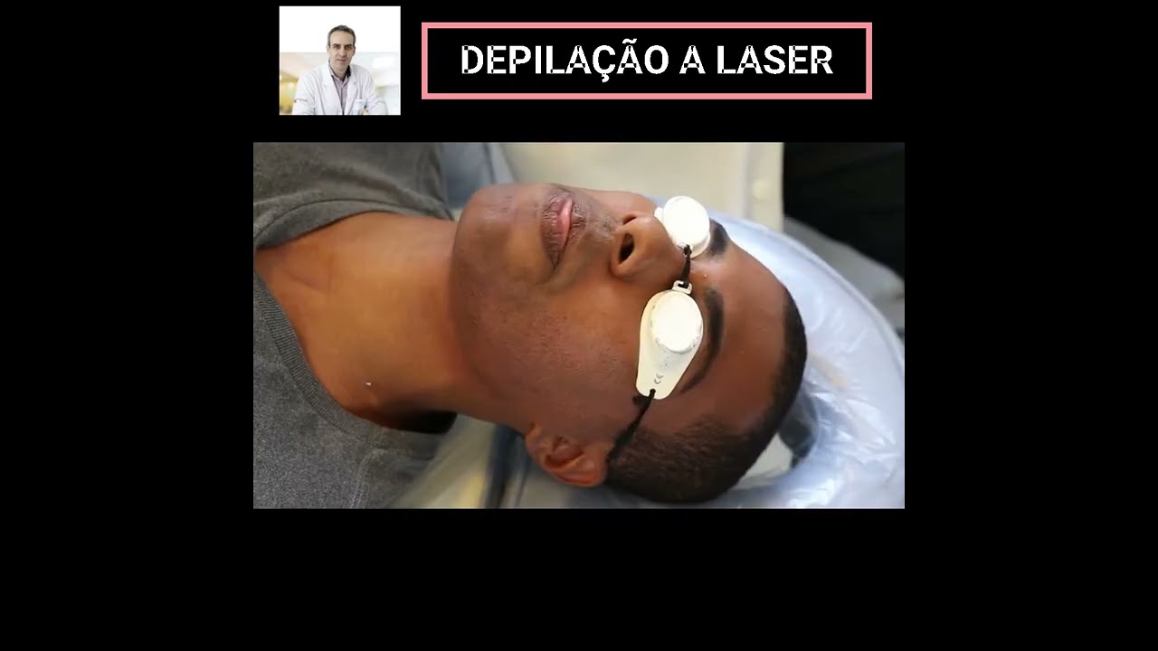 Depilação a Laser: Tudo o que você Precisa Saber e uma dica de Ouro!