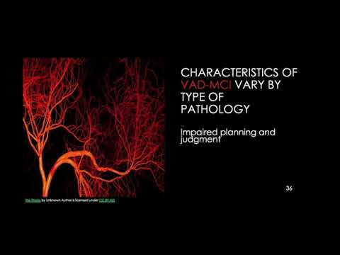 #e265 Preview: Mild Cognitive Impairment Assessment: Challenges and Solutions