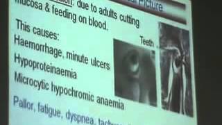 Dr Azza 13 30 11 2014   YouTube