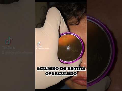 Luis Braulio Pérez González-3