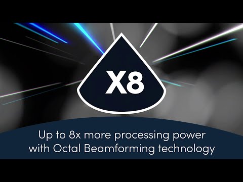 High Definition Cardiac Imaging with Clarius PA HD