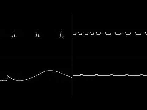 4Mat - Amiga Memories (Oscilloscope View)
