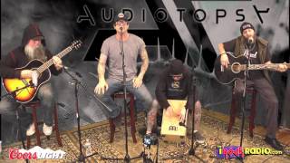 iRockRadio.com - Audiotopsy (Acoustic) - The Calling