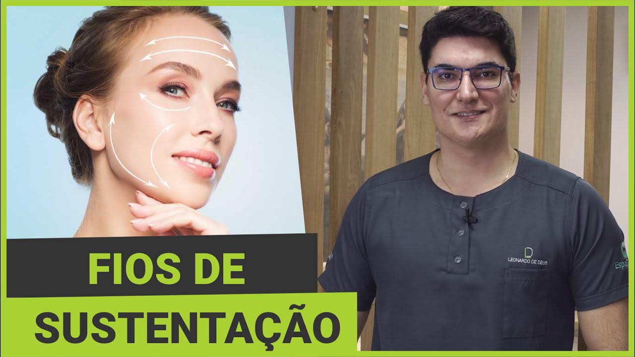 Fios de Sustentação