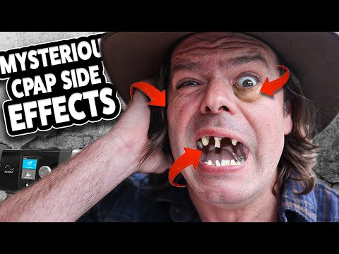 Mysterious CPAP Side Effects - Puffy Eyes, Ear Pain & Tooth Decay