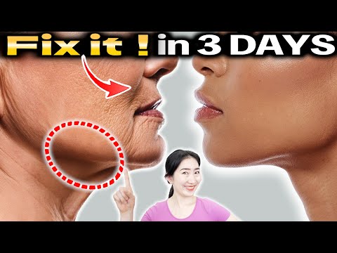 How to Lose Nasolabial Folds and Jowls to Get a Tightened Jawline in 3 Days