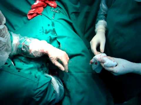 Lagente eziologico della femmina scende a comprare a Novorossiysk Medico su potenza sessuale maschile