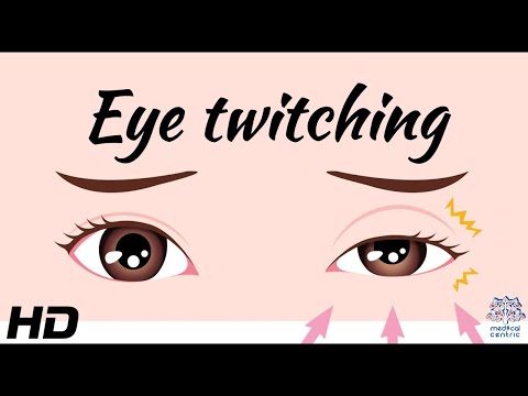 The Science Behind Eyelid Twitching: Explained