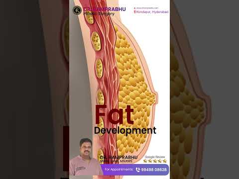 Male chest contouring short video thumbnail by Dr. Ram Prabhu.
