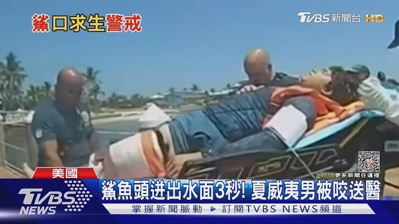 整隻腳在牠嘴裡!衝浪卻遇鯊魚咬人 美國少女驚魂記