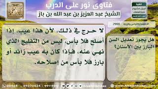 صورة 2988 - حكم تعديل السن البارز بين الأسنان - نور على الدرب