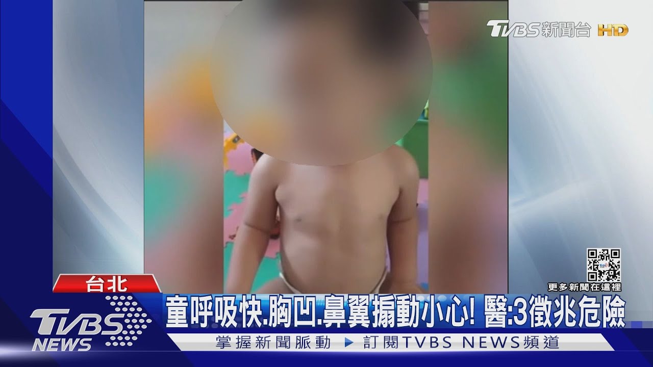 童呼吸快、胸凹、鼻翼搧動小心!醫:3徵兆危險