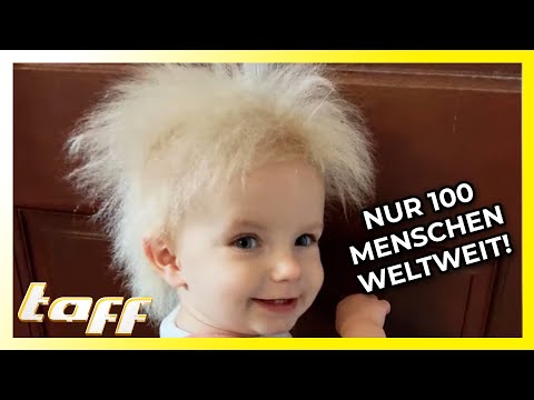 Struwwelpeter Syndrome: What's Behind It? | taff | ProSieben
