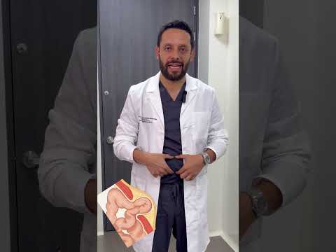 Elkin Eduardo Benítez Navarrete-64