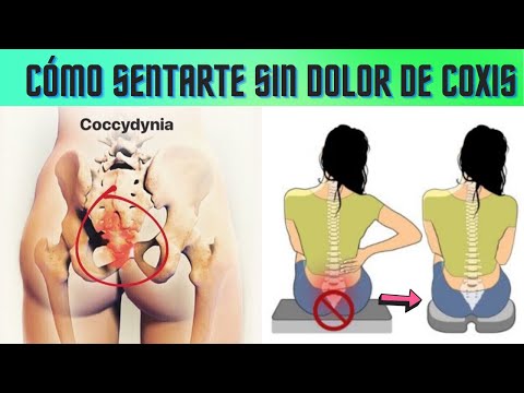 Consejos De Un Fisioterapeuta Para Aliviar Las Molestias En El Coxis