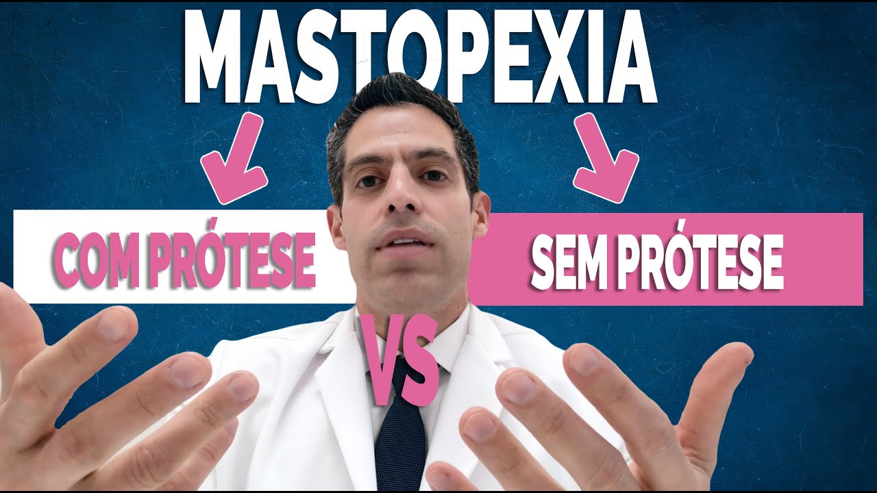 Mastopexia com prótese ou sem prótese: qual a melhor?
