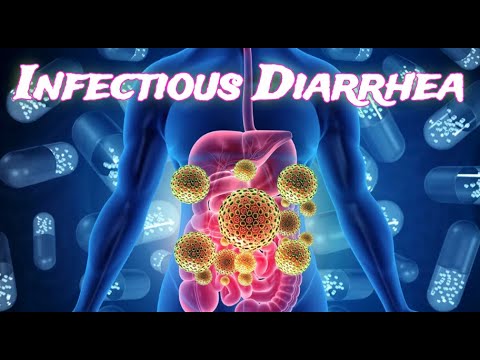 Infectious Diarrhea (updated 2023) - CRASH! Medical Review Series