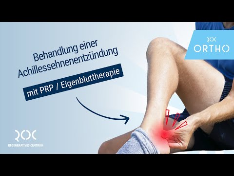 PRP / Eigenbluttherapie bei einer Achillessehnenentzündung - ROC