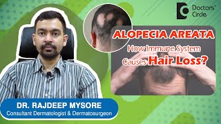 ALOPECIA AREATA & Triggers. How to prevent PATCHY HAIR LOSS? - Dr. Rajdeep Mysore | Doctors
