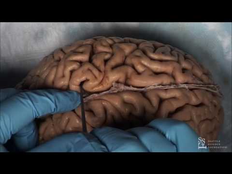 Lab Demo - Practical Anatomy of the Brain Sulci & Gyri by Guilherme Carvalhal Ribas, M.D.