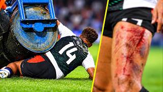 Scariest & Most Unexpected Football Moments 😱