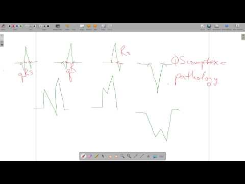 ECG Waves Segments Intervals