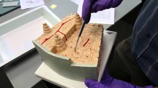Microscopic Anatomy Compact Bone
