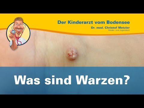 Was sind Warzen? - Der Kinderarzt vom Bodensee [Warzen 1/2]