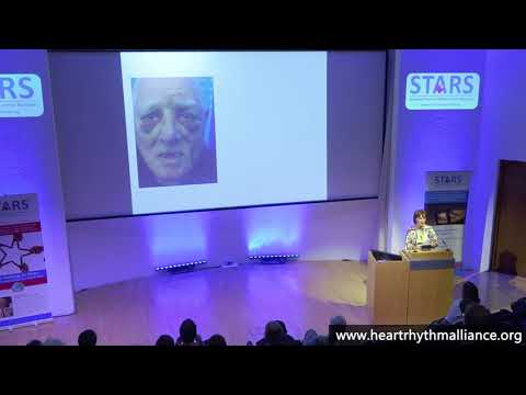 London Syncope Meeting, June 2019 - Falls and the overlap with syncope - Rose Anne Kenny