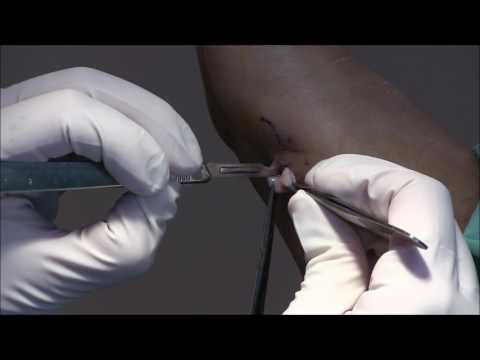 Kollagén injekció – Calendula Clinic