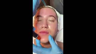 Deluxe HydraFacial at InSpa