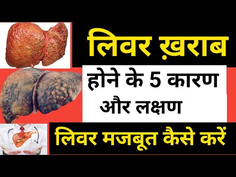 लिवर खराब होने के 5 कारण // Liver kharab hone ke karan // liver kharab hone k lakshan aur upay