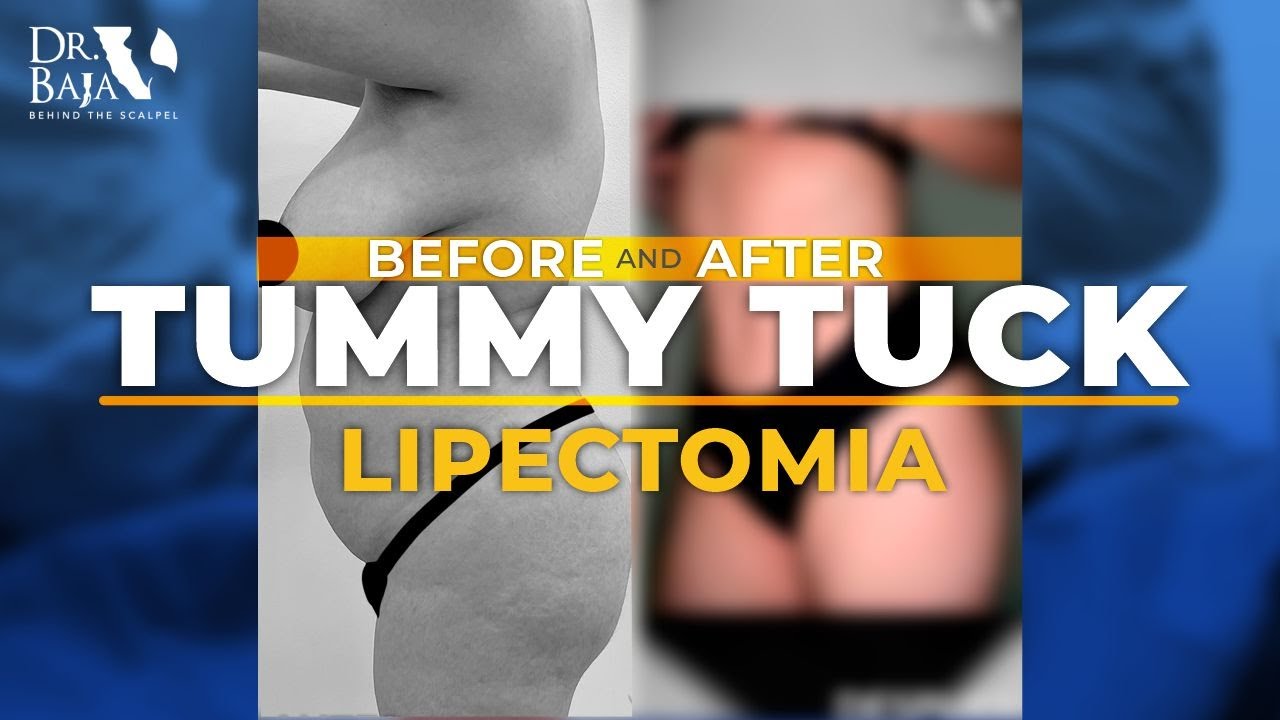 Renato Rodríguez Hirales-57